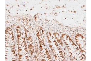 IHC-P Image PNPase antibody detects PNPase protein at mitochondria on human normal colon by immunohistochemical analysis.
