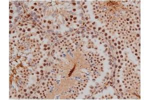 Immunohistochemistry (IHC) image for anti-Sp1 Transcription Factor (SP1) (pThr453) antibody (ABIN6256566)