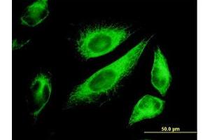 Image no. 5 for anti-Keratin 18 (KRT18) (AA 1-431) antibody (ABIN598778) (Cytokeratin 18 抗体  (AA 1-431))