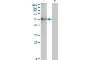 Western Blot analysis of TAPBPL expression in transfected 293T cell line by TAPBPL monoclonal antibody (M02), clone 6E3.
