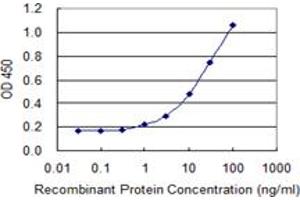 Detection limit for recombinant GST tagged PAGE1 is 0. (PAGE1 抗体  (AA 1-146))