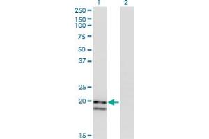 Western Blot analysis of IFNA2 expression in transfected 293T cell line by IFNA2 monoclonal antibody. (IFNA2 抗体  (AA 24-188))