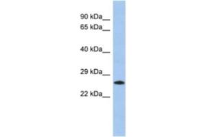 Western Blotting (WB) image for anti-MGC50273 antibody (ABIN2463949) (MGC50273 抗体)