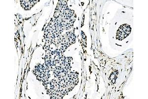 IHC analysis of splicing factor 1 using anti-splicing factor 1 antibody (ABIN7600194).