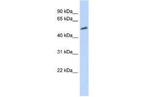 WB Suggested Anti-IKZF2 Antibody Titration: 0. (IKZF2 抗体  (Middle Region))