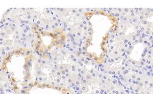 Detection of STAR in Human Kidney Tissue using Polyclonal Antibody to Steroidogenic Acute Regulatory Protein (STAR) (STAR 抗体  (AA 1-285))