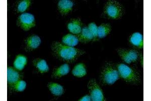 IF analysis of PDP1/PDP using anti-PDP1/PDP antibody (ABIN7601509).