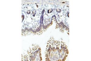 IHC analysis of TEK using anti-TEK antibody (ABIN7600762). (TEK 抗体  (AA 23-616))