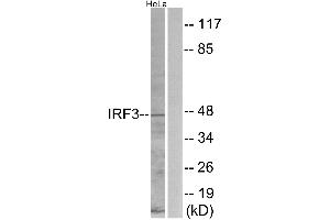 Immunohistochemistry analysis of paraffin-embedded human brain tissue using IRF3 (Ab-396) antibody. (IRF3 抗体  (Ser396))