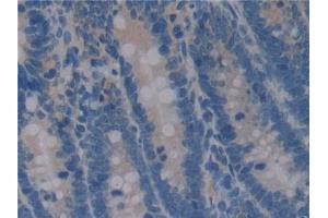 Immunohistochemistry (IHC) image for anti-Secreted phosphoprotein 1 (SPP1) (AA 17-317) antibody (ABIN7443842)
