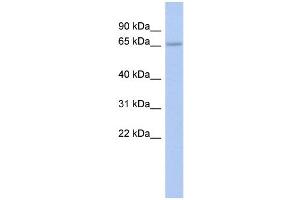 WB Suggested Anti-ZNF248 Antibody Titration:  0. (ZNF248 抗体  (Middle Region))