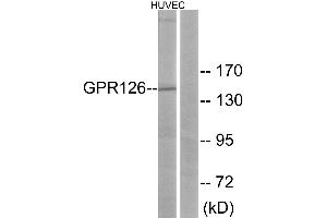 Western blot analysis of extracts from HUVEC cells, using GPR126 antibody. (G Protein-Coupled Receptor 126 抗体)