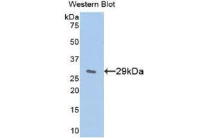 Western Blotting (WB) image for anti-Inhibitory Subunit of NF-KappaB epsilon (AA 207-440) antibody (ABIN1859320) (Inhibitory Subunit of NF-KappaB epsilon (AA 207-440) 抗体)