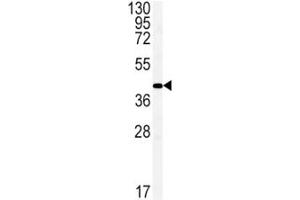 Western Blotting (WB) image for anti-Gap Junction Protein, alpha 1, 43kDa (GJA1) (AA 107-138) antibody (ABIN3031020)