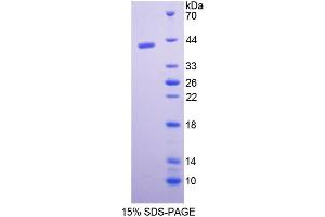 SDS-PAGE of Protein Standard from the Kit (Highly purified E.
