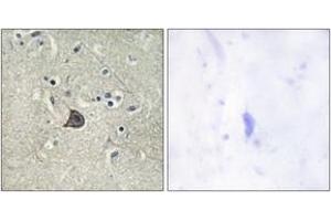 Immunohistochemistry analysis of paraffin-embedded human brain, using PLC beta3 (Phospho-Ser537) Antibody. (PLCB3 抗体  (pSer537))