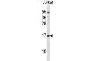 Western Blotting (WB) image for anti-Transcription Elongation Factor B (SIII), Polypeptide 1 (15kDa, Elongin C) (TCEB1) antibody (ABIN2998260) (TCEB1 抗体)