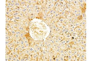 ABIN7094239 and ABIN7098286 at 1/100 staining Mouse liver tissue by IHC-P.