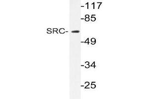 Western blot (WB) analyzes of SRC antibody in extracts from 293 cells. (NCOA1 抗体)