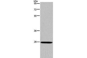Western Blot analysis of Mouse spleen tissue using KLK14 Polyclonal Antibody at dilution of 1:300 (Kallikrein 14 抗体)