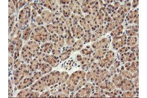 Image no. 1 for anti-F-Box Protein 21 (FBXO21) antibody (ABIN1498234) (FBXO21 抗体)