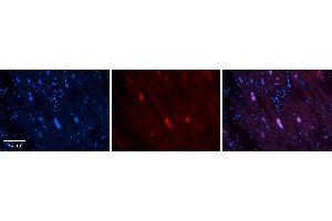 Rabbit Anti-MCM4 Antibody   Formalin Fixed Paraffin Embedded Tissue: Human heart Tissue Observed Staining: Nucleus Primary Antibody Concentration: 1:100 Other Working Concentrations: N/A Secondary Antibody: Donkey anti-Rabbit-Cy3 Secondary Antibody Concentration: 1:200 Magnification: 20X Exposure Time: 0. (MCM4 抗体  (Middle Region))