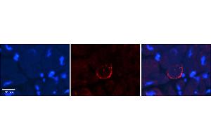 Immunohistochemistry (IHC) image for anti-Sodium Channel, Voltage-Gated, Type VIII, alpha (SCN8A) (C-Term) antibody (ABIN2776200)