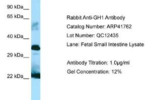 Western Blotting (WB) image for anti-Growth Hormone 1 (GH1) (C-Term) antibody (ABIN2776979) (Growth Hormone 1 抗体  (C-Term))