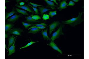 Immunofluorescence of purified MaxPab antibody to ST13 on HeLa cell. (HSC70 Interacting Protein HIP 抗体  (AA 1-369))