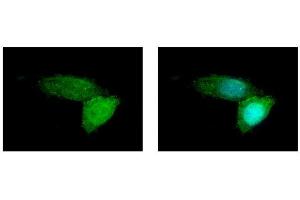 Immunofluorescence (IF) image for anti-ATP-Binding Cassette, Sub-Family B (MDR/TAP), Member 11 (ABCB11) (Internal Region) antibody (ABIN2855437)