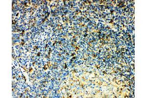 Anti-CCR3 antibody, IHC(P) IHC(P): Human Tonsil Tissue (CCR3 抗体  (N-Term))