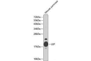 Western blot analysis of extracts of Mouse pancreas using LEP Polyclonal Antibody at dilution of 1:1000. (Leptin 抗体)
