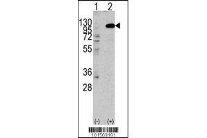 Western blot analysis of anti-hFGFR2-C808 Pab in 293 cell line lysates transiently transfected with the FGFR2 gene (2ug/lane)