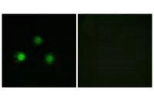 Immunofluorescence analysis of HUVEC cells, using MSH2 antibody. (MSH2 抗体)