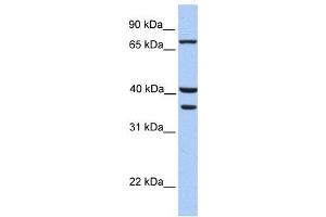 Western Blotting (WB) image for anti-Transglutaminase 5 (TGM5) antibody (ABIN2459269) (Transglutaminase 5 抗体)