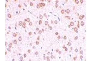 Immunohistochemistry of TLR5 in rat brain tissue with this product at 10 μg/ml. (TLR5 抗体  (Center))