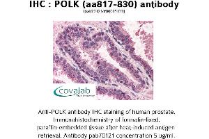 Image no. 1 for anti-Polymerase (DNA Directed) kappa (POLK) (AA 817-830) antibody (ABIN1738191) (POLK 抗体  (AA 817-830))