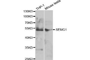 Western Blotting (WB) image for anti-Semenogelin I (SEMG1) antibody (ABIN1876675) (SEMG1 抗体)
