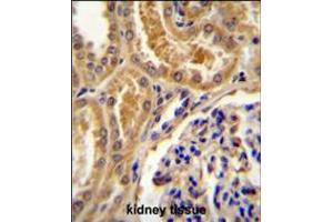 TLL2 Antibody immunohistochemistry analysis in formalin fixed and paraffin embedded human kidney tissue followed by peroxidase conjugation of the secondary antibody and DAB staining. (Tolloid-Like 2 抗体  (AA 298-328))