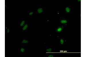 Image no. 4 for anti-Oxidative-Stress Responsive 1 (OXSR1) (AA 1-528) antibody (ABIN599106) (OXSR1 抗体  (AA 1-528))