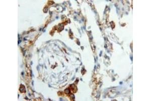 Used in DAB staining on fromalin fixed paraffin-embedded Lung tissue (XCL1 抗体  (AA 23-113))