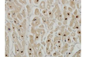 Immunoperoxidase of monoclonal antibody to TTN on formalin-fixed paraffin-embedded human heart. (Titin 抗体  (AA 1-110))
