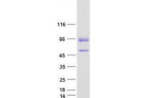 Western Blotting (WB) image for TOX High Mobility Group Box Family Member 2 (TOX2) (Transcript Variant 4) protein (Myc-DYKDDDDK Tag) (ABIN2734032)