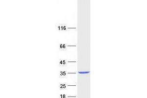 Western Blotting (WB) image for Sulfotransferase Family, Cytosolic, 1A, Phenol-Preferring, Member 1 (SULT1A1) (Transcript Variant 2) protein (Myc-DYKDDDDK Tag) (ABIN2732948)