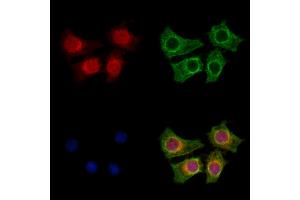 ABIN7094601 and ABIN7098651 staining HepG2 cells by IF/ICC.