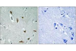Immunohistochemistry analysis of paraffin-embedded human brain, using AKT1/3 (Phospho-Tyr437/434) Antibody. (AKT1/3 (AA 406-455), (pTyr437) 抗体)