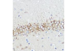 Immunohistochemistry (IHC) image for anti-Abl-Interactor 1 (ABI1) (AA 180-230) antibody (ABIN7265359)