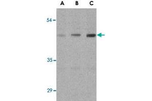 Western blot analysis of ANTXR1 in HepG2 cell lysates with ANTXR1 polyclonal antibody  at (A) 0. (ANTXR1 抗体  (Internal Region))