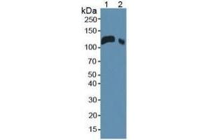 Rabbit Detection antibody from the kit in WB with Positive Control:  Sample Sample: Lane1: Mouse Serum; Lane2: Mouse Placenta Tissue. (LIFR ELISA 试剂盒)