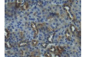 DAB staining on IHC-P; Samples: Mouse Kidney Tissue (IGFBP3 抗体  (AA 152-292))